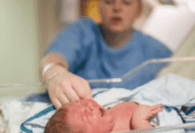 Preterm Birth