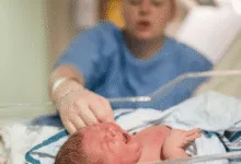 Preterm Birth