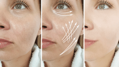 Face Wrinkles Treatment