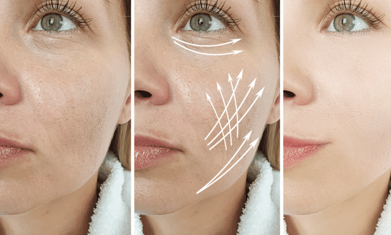 Face Wrinkles Treatment