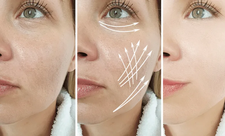 Face Wrinkles Treatment