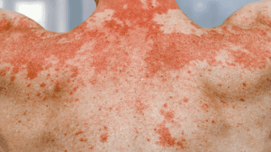 தோல் நோய்க்கு சாப்பிட வேண்டிய உணவுகள்